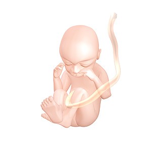 Semana 20